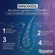 Regaine for Women Regular Strength 2% Minoxidil Scalp Solution – 60ml