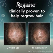 Regaine for Men Extra Strength Hair Regrowth Treatment (3 x 73ml)